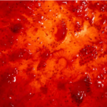 Strawberry Jam 5